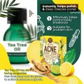 New Beauty Secret 4 Acne Body Clear Soap 70g