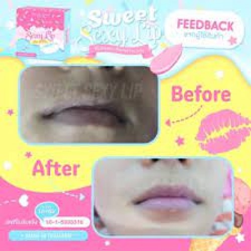 Sweet Sexy Lip Pinkish Organic Balm 3in1 Lip Treatment 10g Lips Cracked Lip Chapped Lips