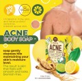 New Beauty Secret 4 Acne Body Clear Soap 70g